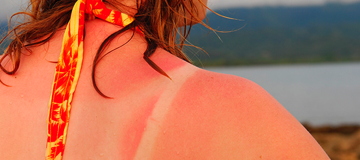 Auto-bronzants : Une nouvelle substance pour aider la peau à produire de la mélanine sans UV