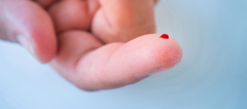 Australie : Des chercheurs développent un test sanguin pour détecter le mélanome